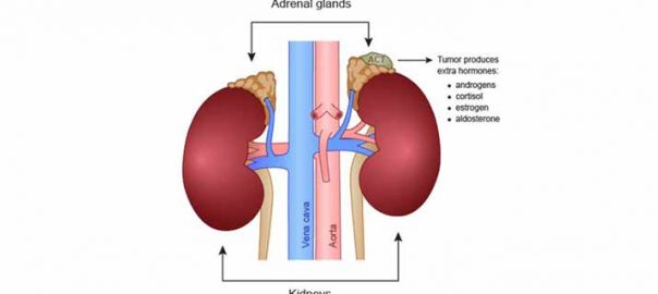 The Spiritual Reason Behind Adrenal Tumors - TruLight Radio XM