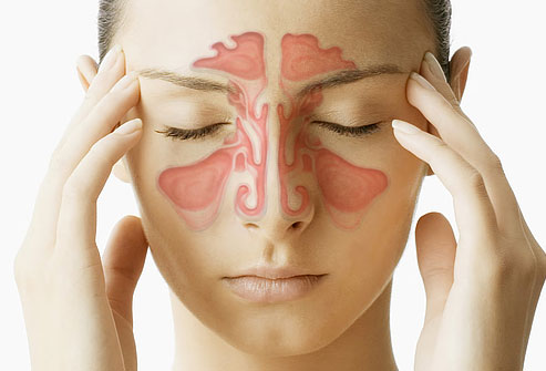 The spiritual Reason Behind Sinusitis