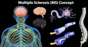 The Spiritual Reason Behind Multiple Sclerosis